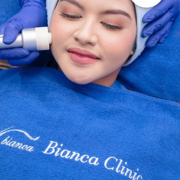 Microdermabrasi2