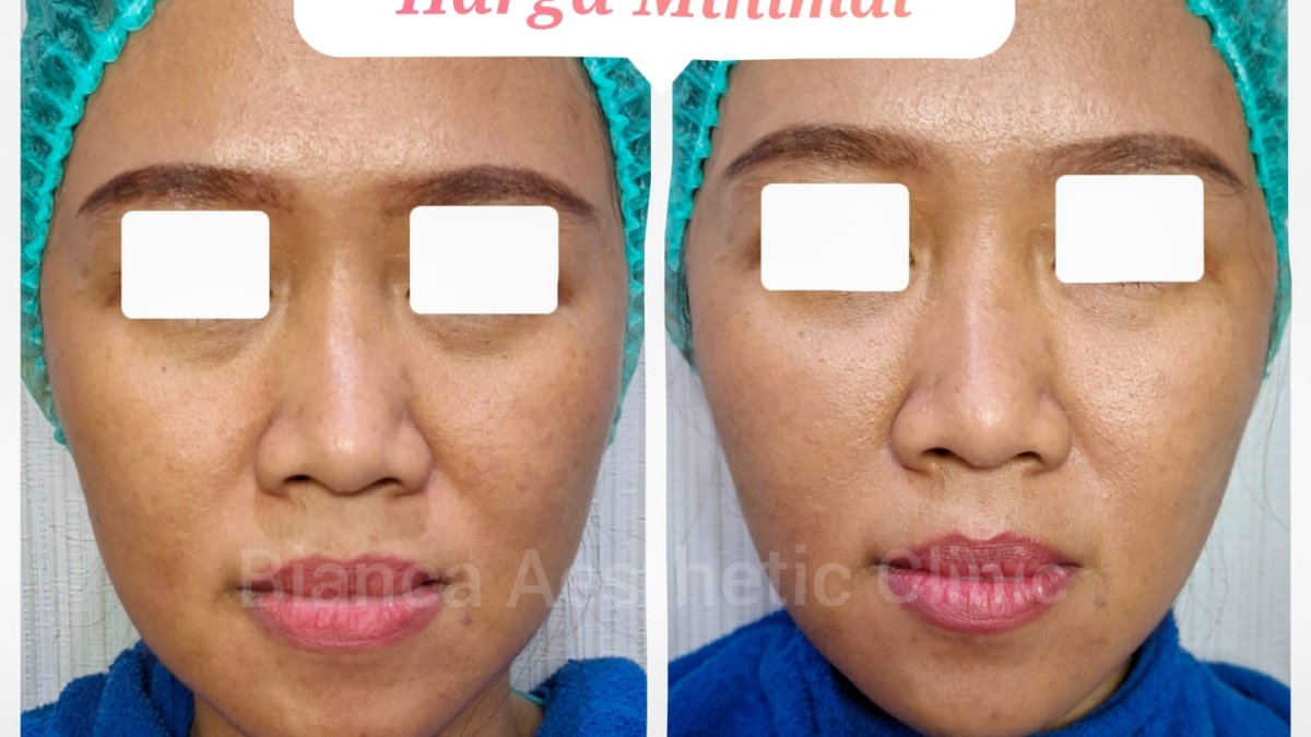 Kencang Maksimal Harga Minimal